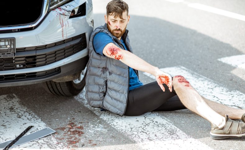 Injured man with bleeding wounds sitting on the pedestrian crossing near the car after the road accident